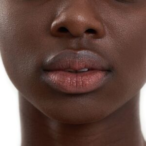 ⁠Dark Lip Neutralization