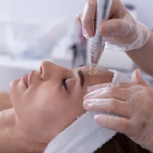 Microneedling