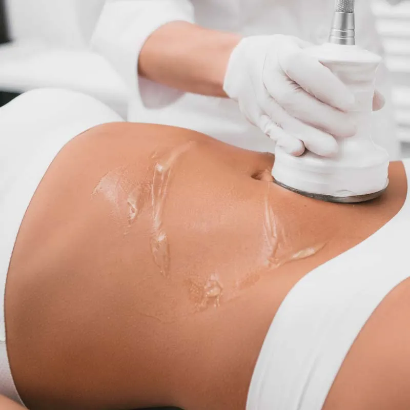Cavitation, RF Skin Tightening, Laser Lipo Trio
